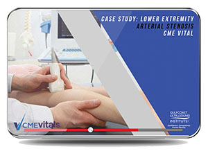 Case Study: Lower Extremity Arterial Stenosis